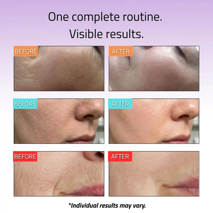 Advanced Skincare Essentials Set (6 Pack)