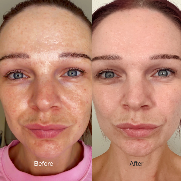 Before and after images showing differences in skin appearance