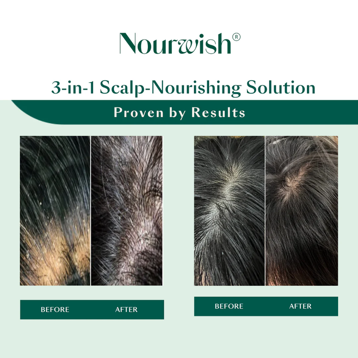 Nourwish Scalp Retreat Nourishing Scalp Serum 59 ml