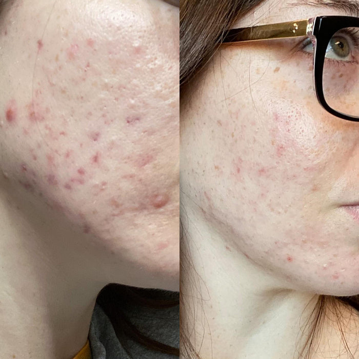 Blissoma Smooth A+ Correcting Serum